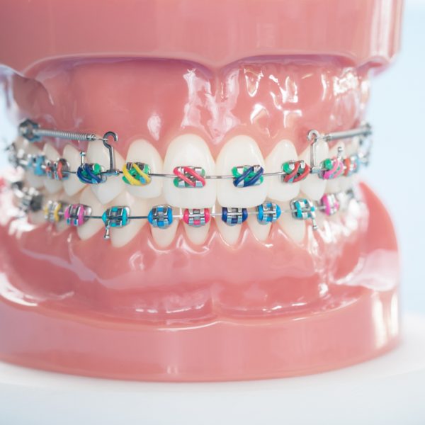 Ortodoncia Invisible Zaragoza | Higiene Dental Y Cuidados Con Brackets